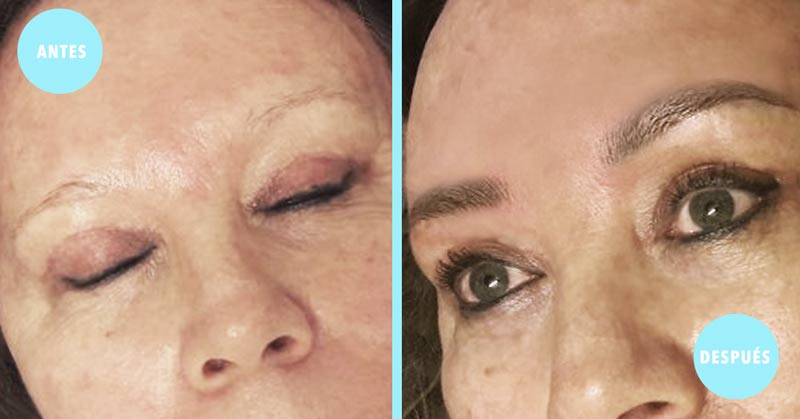 Microblading en Guadalajara Resultados